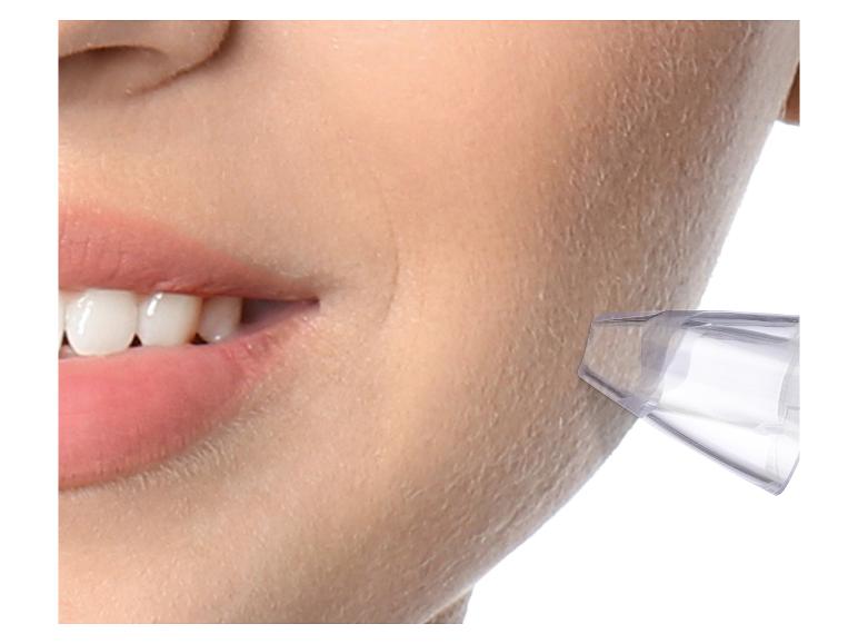 Gezichtreinigingsapparaat in gebruik op de huid.