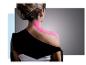 Vrouw met roze sporttape op nek en schouder